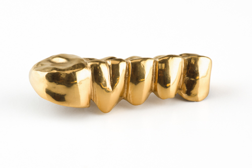 Zahngold